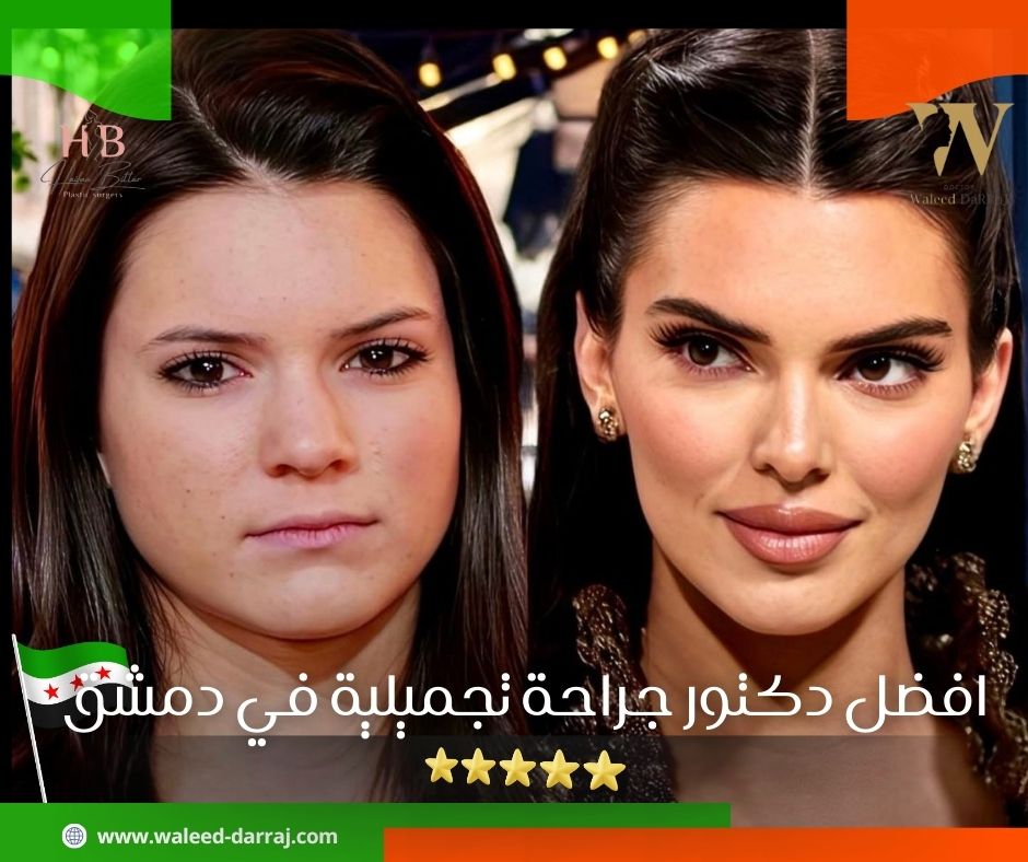 افضل دكتور جراحة تجميلية في دمشق