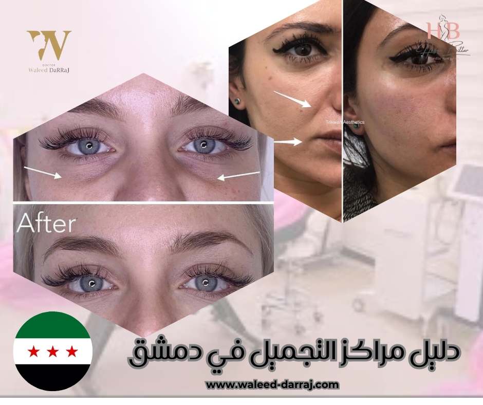 دليل مراكز التجميل في دمشق