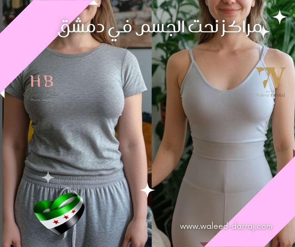 مراكز نحت الجسم في دمشق