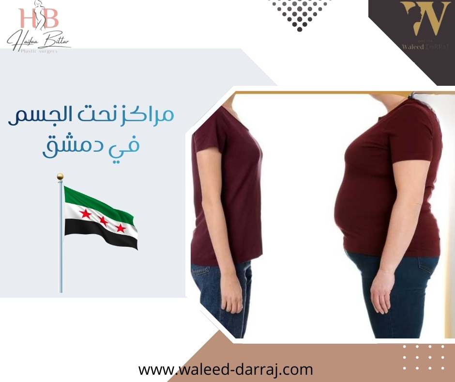 مراكز نحت الجسم في دمشق
