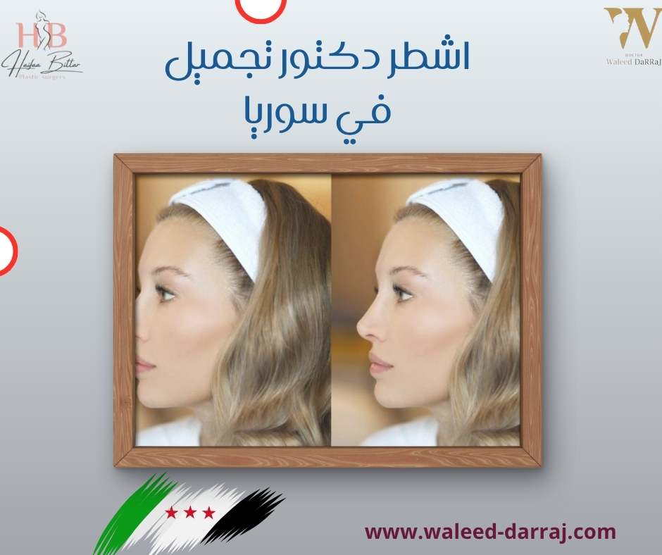 اشطر دكتور تجميل في سوريا