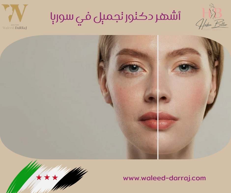 أشهر دكتور تجميل في سوريا