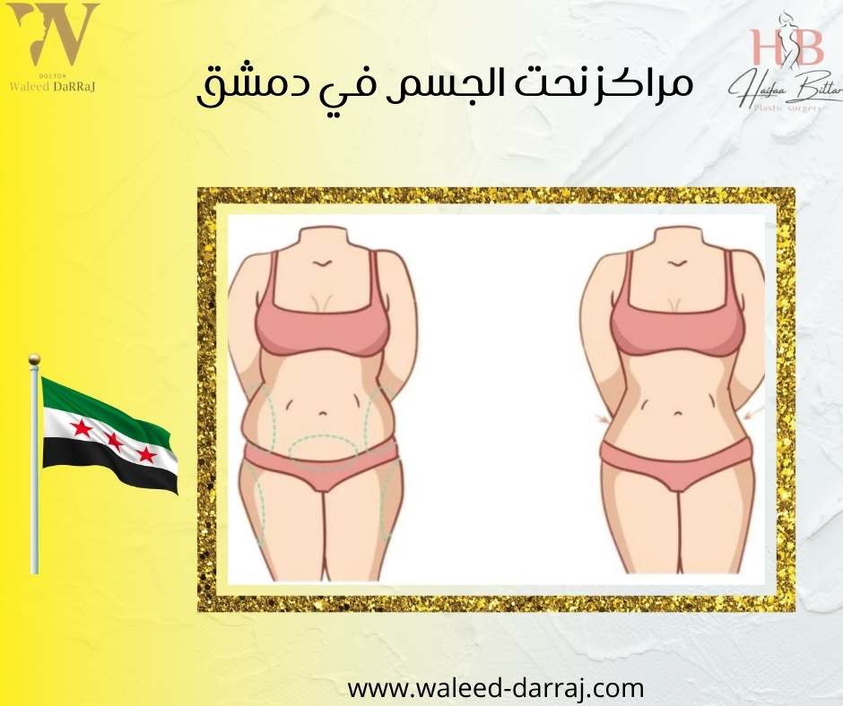 مراكز نحت الجسم في دمشق
