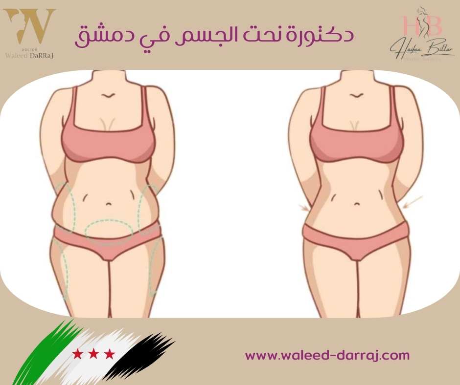 دكتور نحت الجسم في دمشق