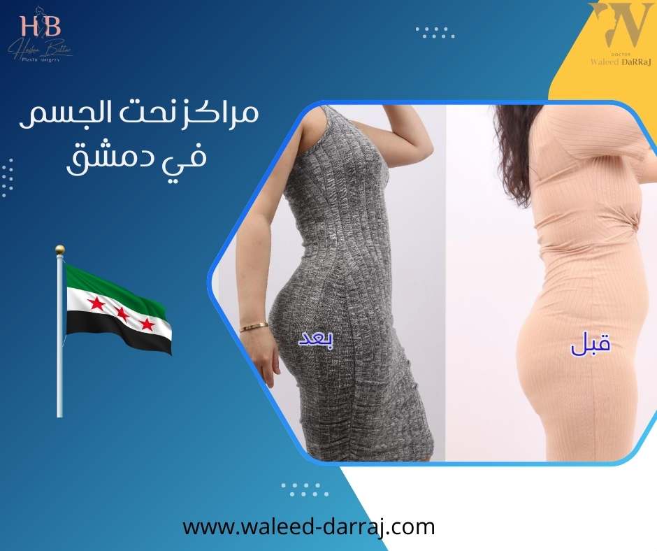 مراكز نحت الجسم في دمشق