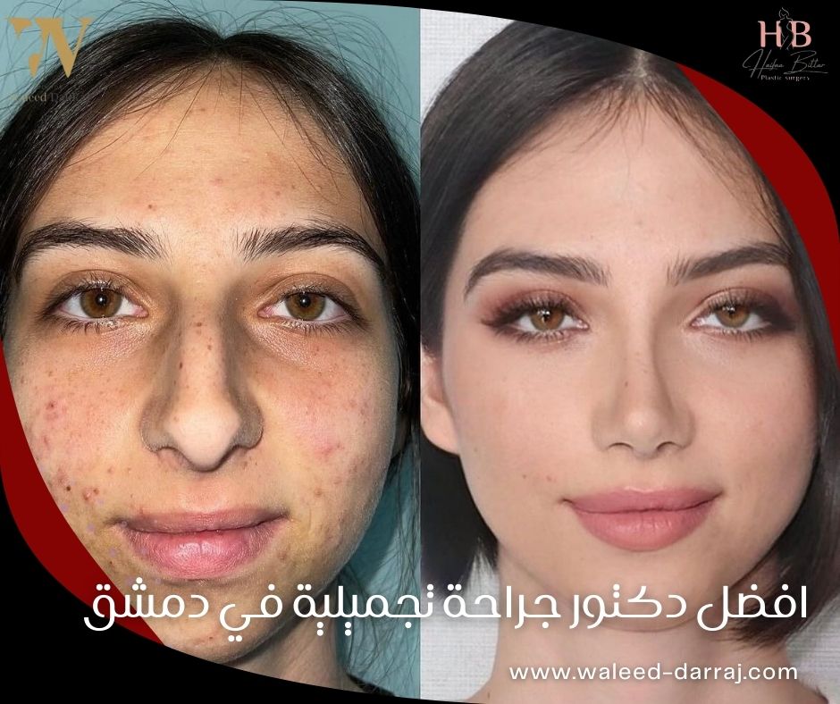 افضل دكتور جراحة تجميلية في دمشق