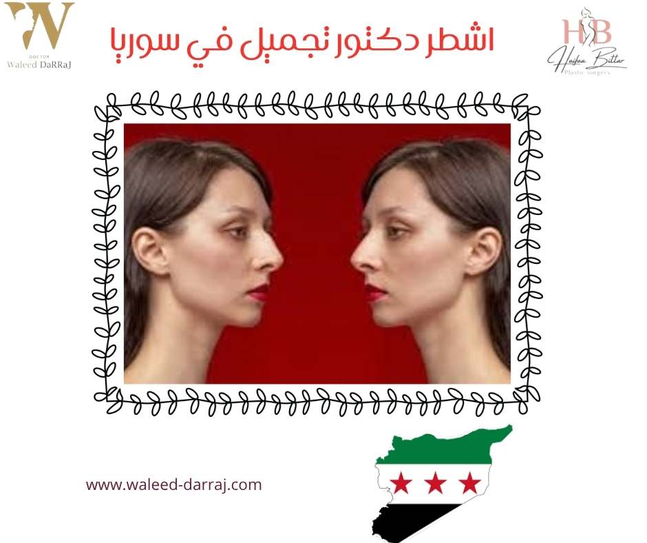 اشطر دكتور تجميل في سوريا