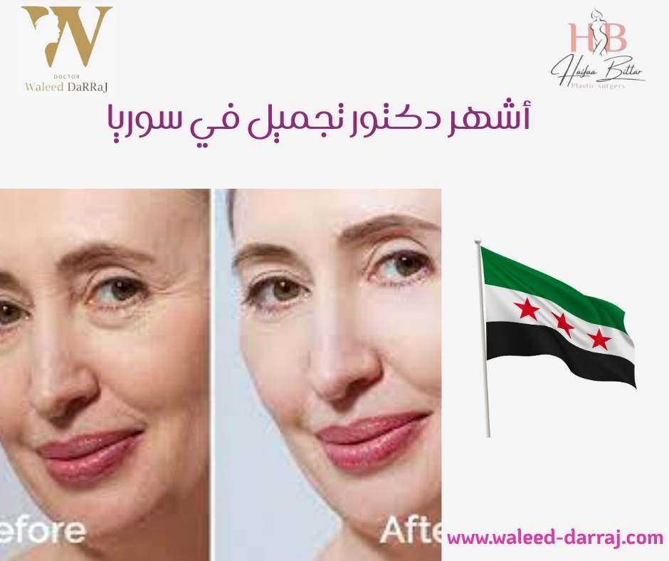 أشهر دكتور تجميل في سوريا