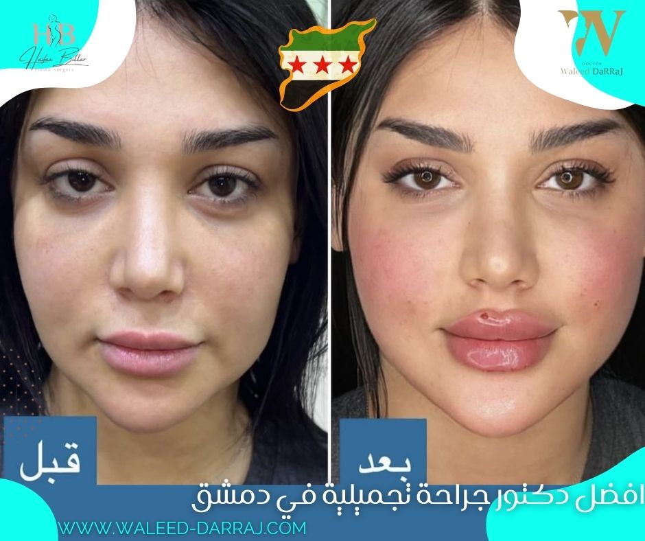 افضل دكتور جراحة تجميلية في دمشق