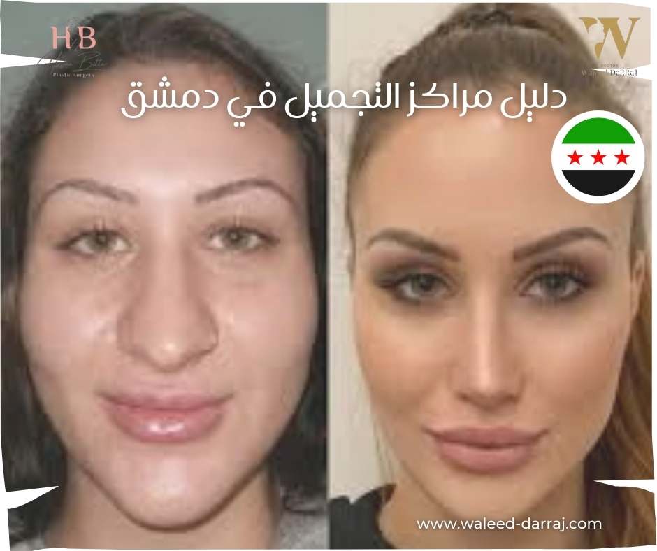 دليل مراكز التجميل في دمشق