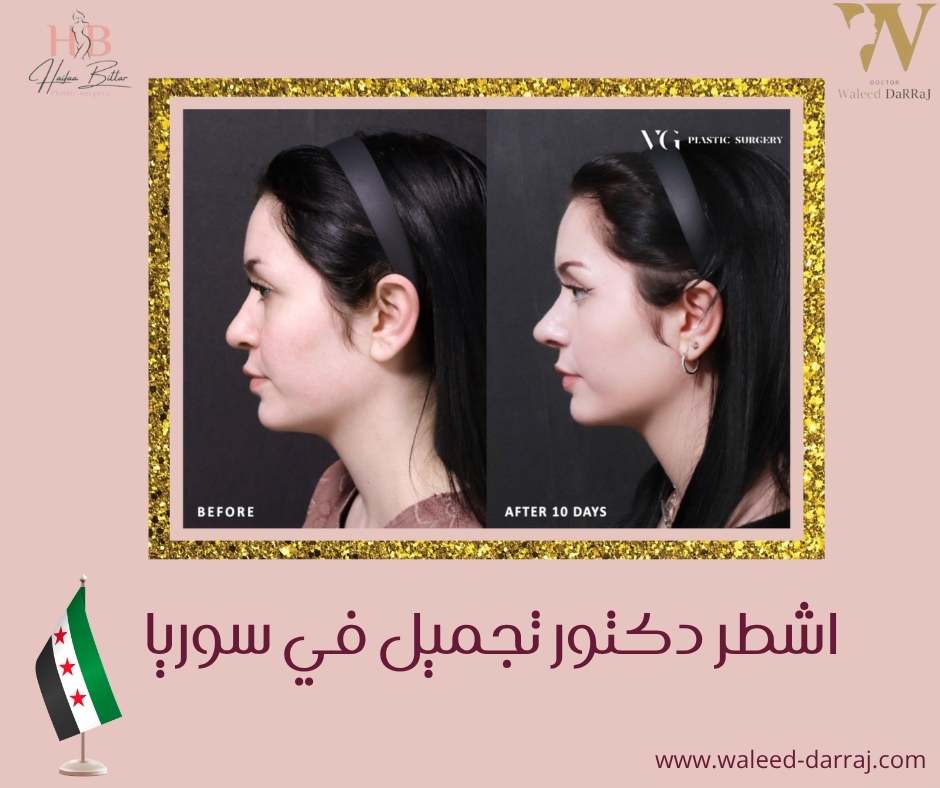 اشطر دكتور تجميل في سوريا