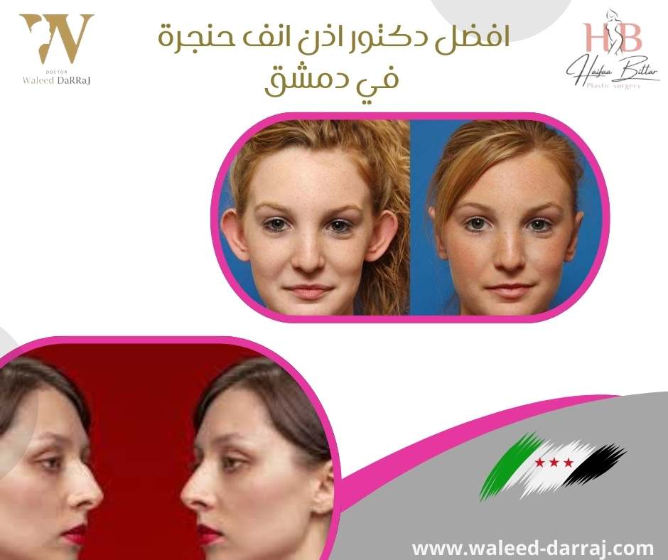 افضل دكتور اذن انف حنجرة في دمشق