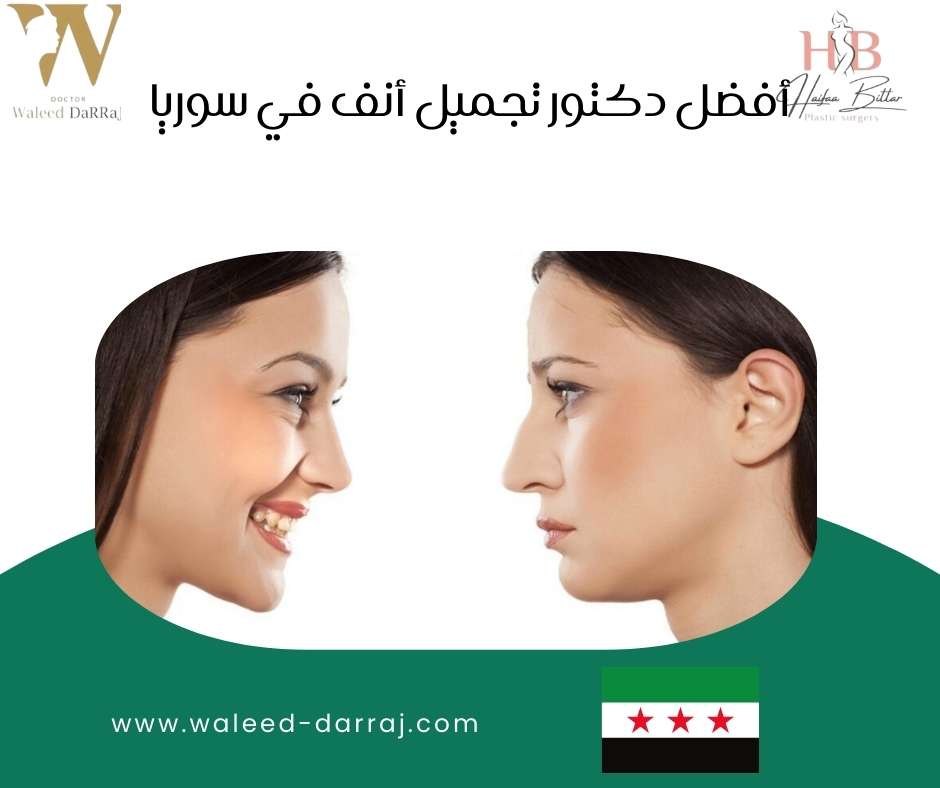 أفضل دكتور تجميل أنف في سوريا