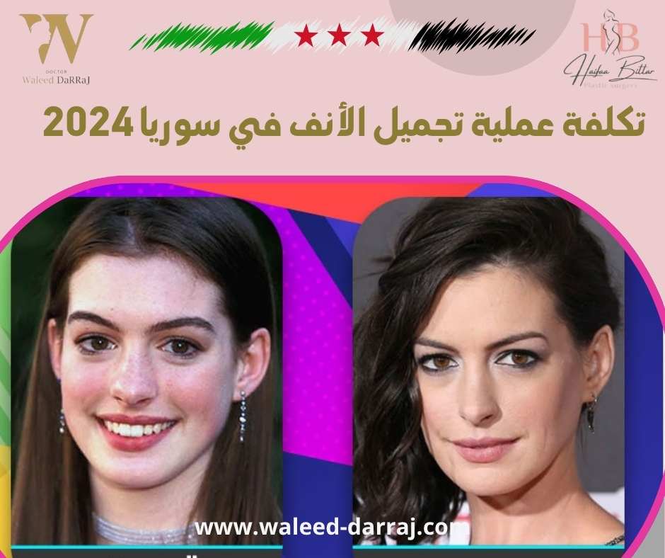 تكلفة عملية تجميل الأنف في سوريا 2024