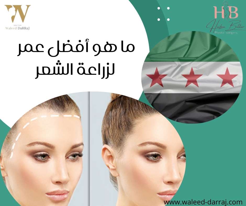 ما هو أفضل عمر لزراعة الشعر