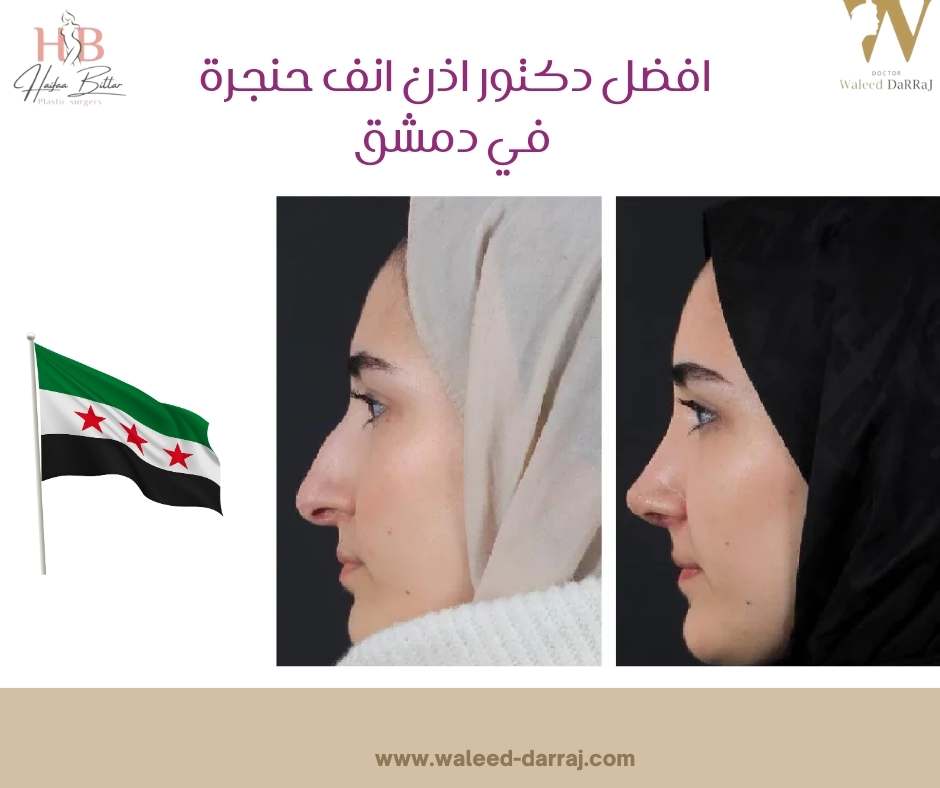 افضل دكتور اذن انف حنجرة في دمشق