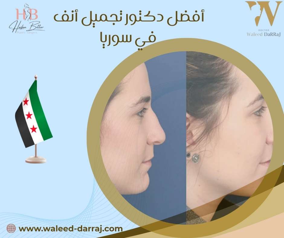 أفضل دكتور تجميل أنف في سوريا