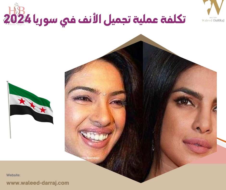 تكلفة عملية تجميل الأنف في سوريا 2024