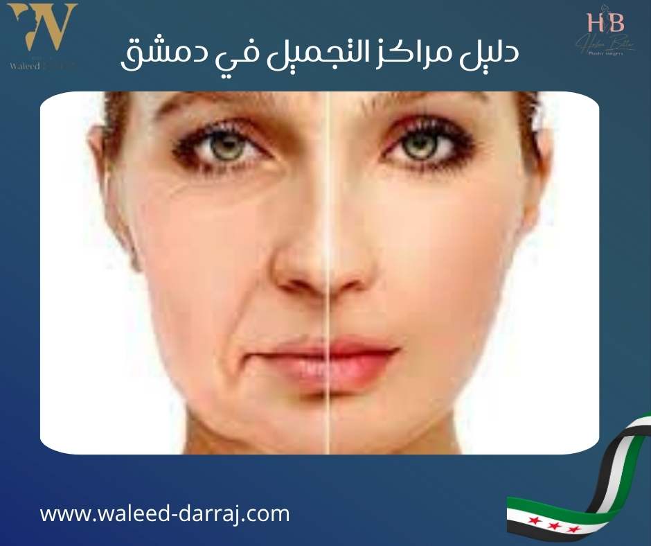 دليل مراكز التجميل في دمشق