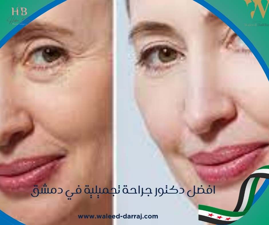 افضل دكتور جراحة تجميلية في دمشق