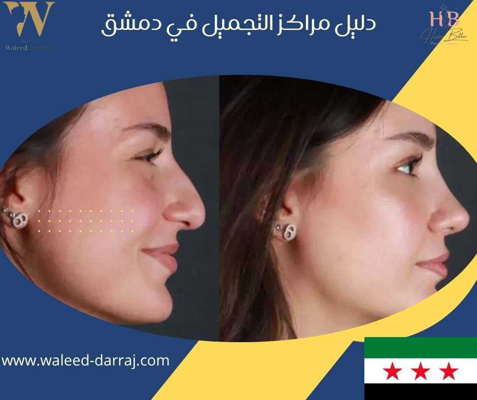 دليل مراكز التجميل في دمشق