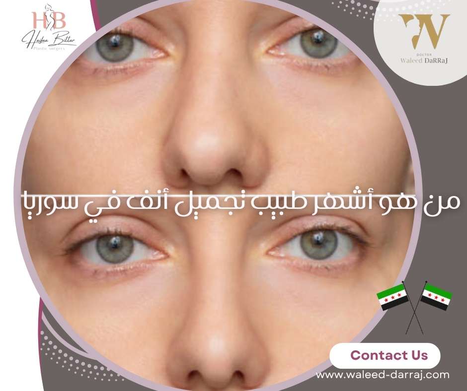 من هو أشهر طبيب تجميل أنف في سوريا ؟