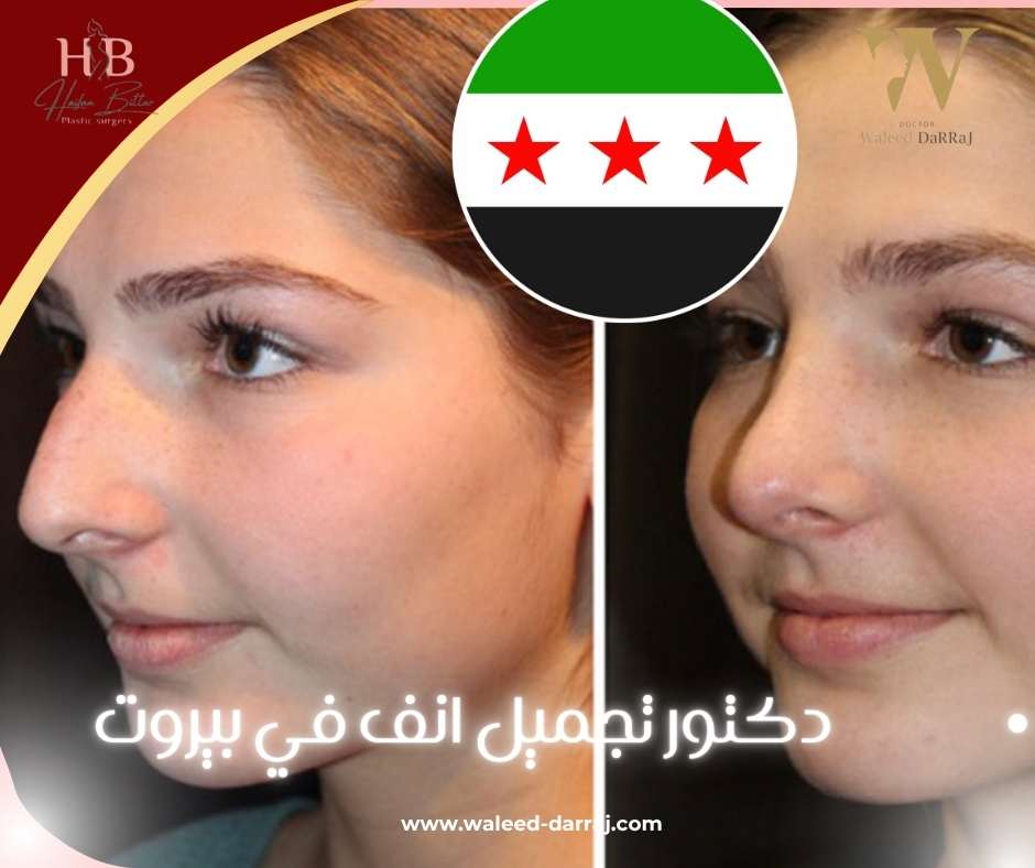 دكتور تجميل انف في بيروت