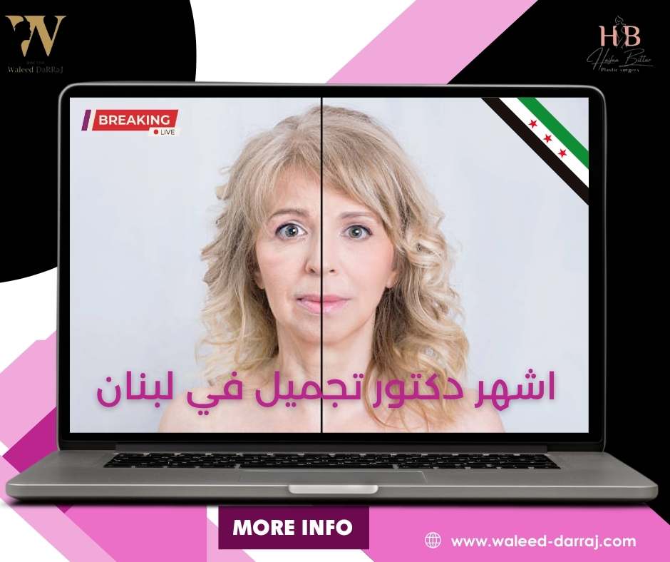 اشهر دكتور تجميل في لبنان