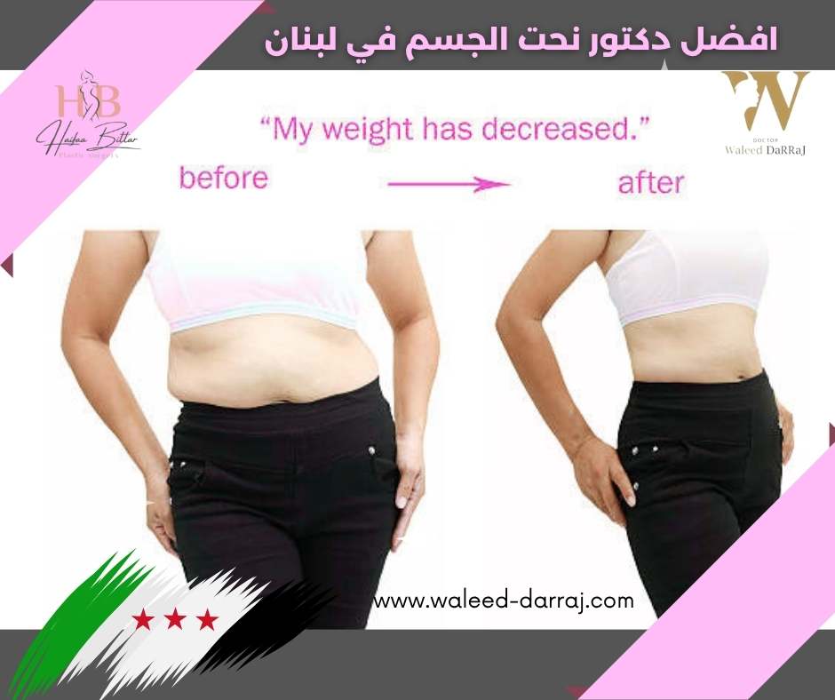 افضل دكتور نحت الجسم في لبنان