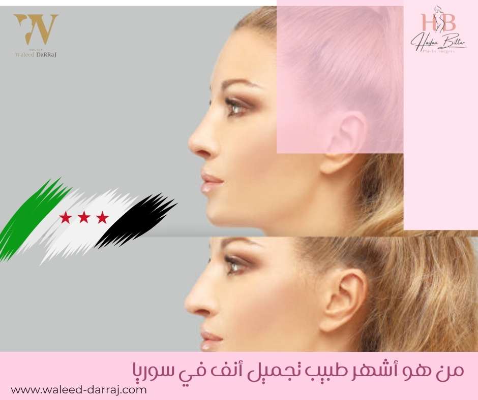 من هو أشهر طبيب تجميل أنف في سوريا ؟