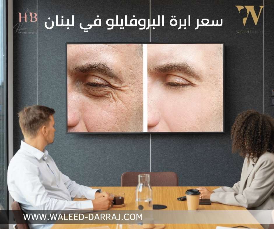 سعر ابرة البروفايلو في لبنان