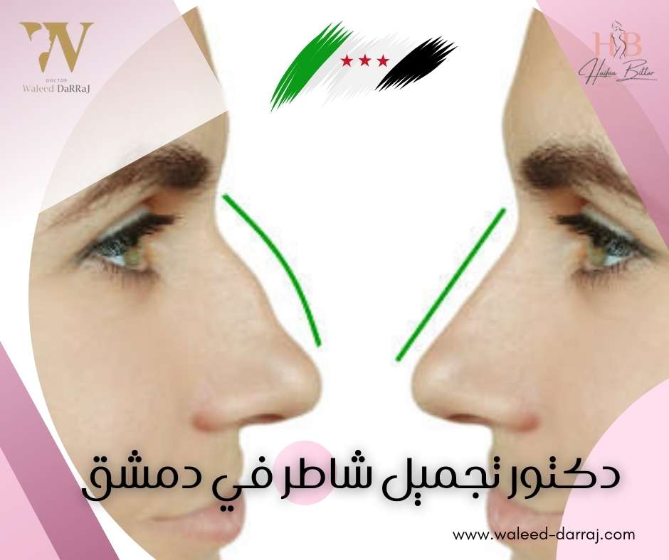من هو أشهر طبيب تجميل أنف في سوريا ؟