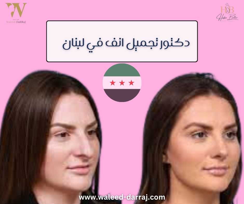 دكتور تجميل انف في لبنان