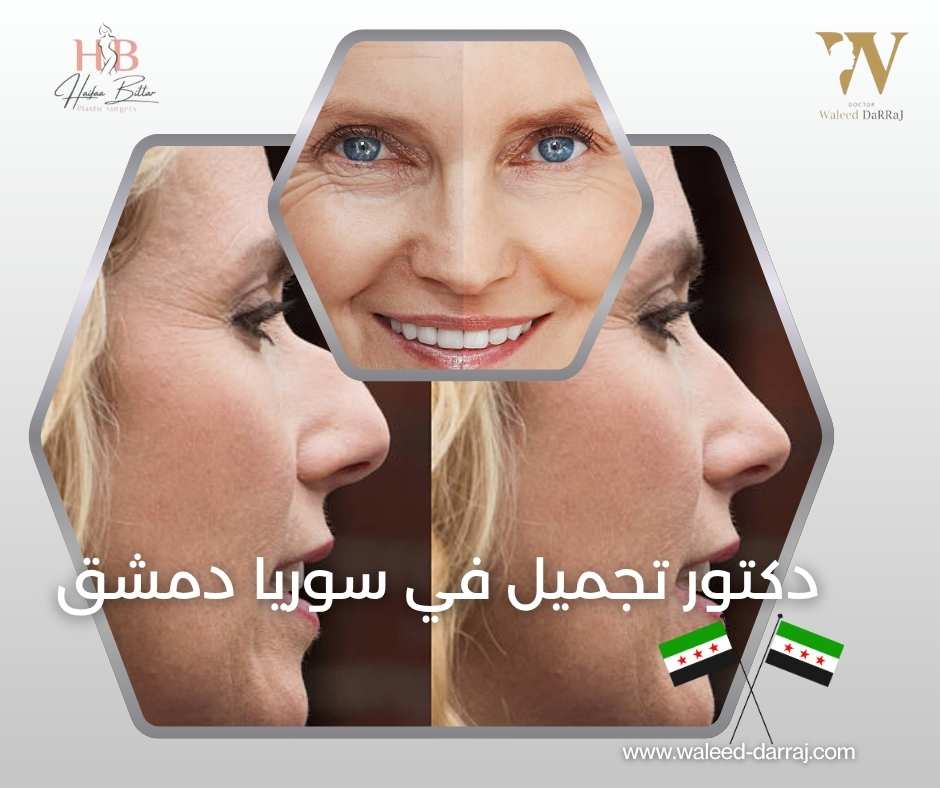 دكتور تجميل في سوريا دمشق