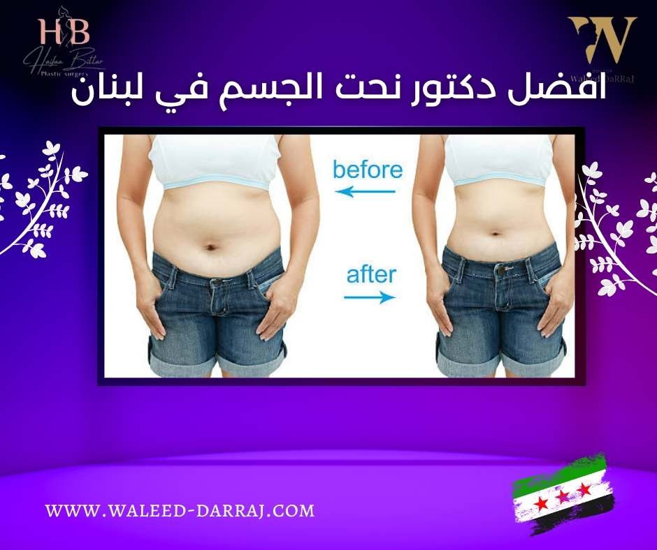 افضل دكتور نحت الجسم في لبنان