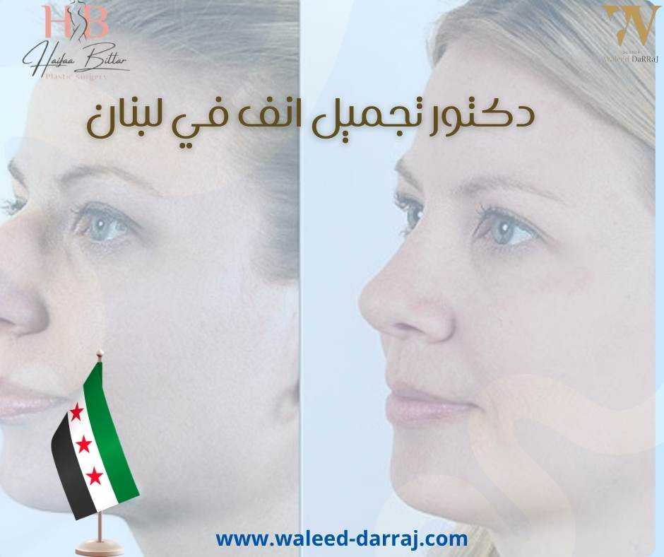 دكتور تجميل انف في لبنان