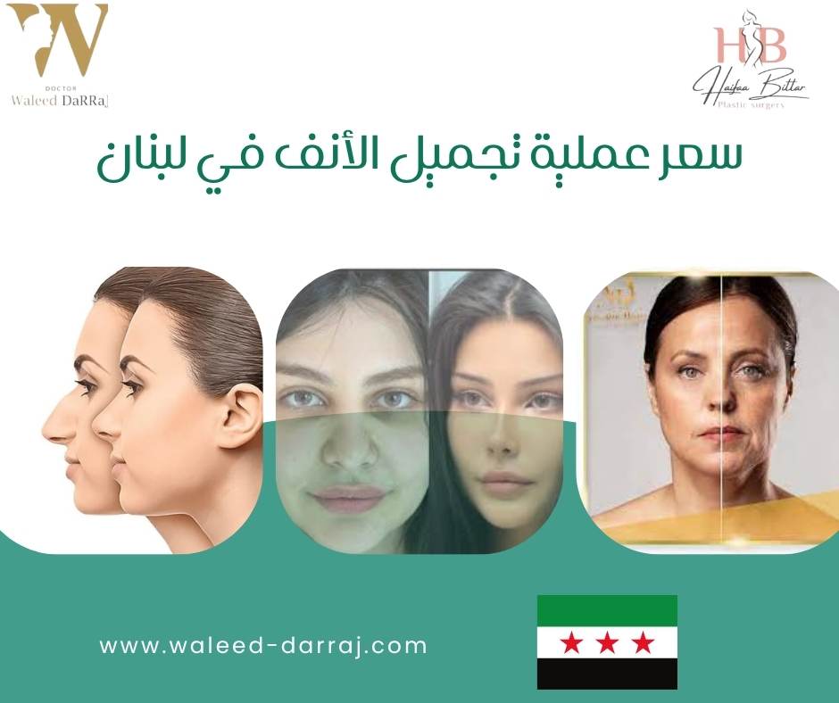 سعر عملية تجميل الأنف في لبنان