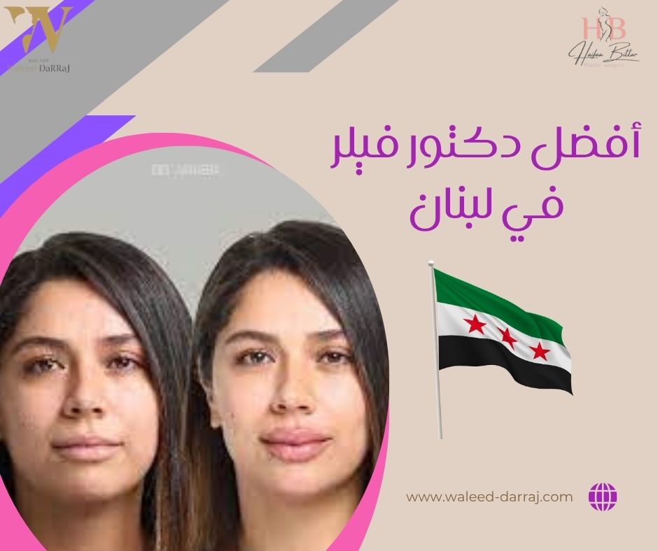 أفضل دكتور فيلر في لبنان