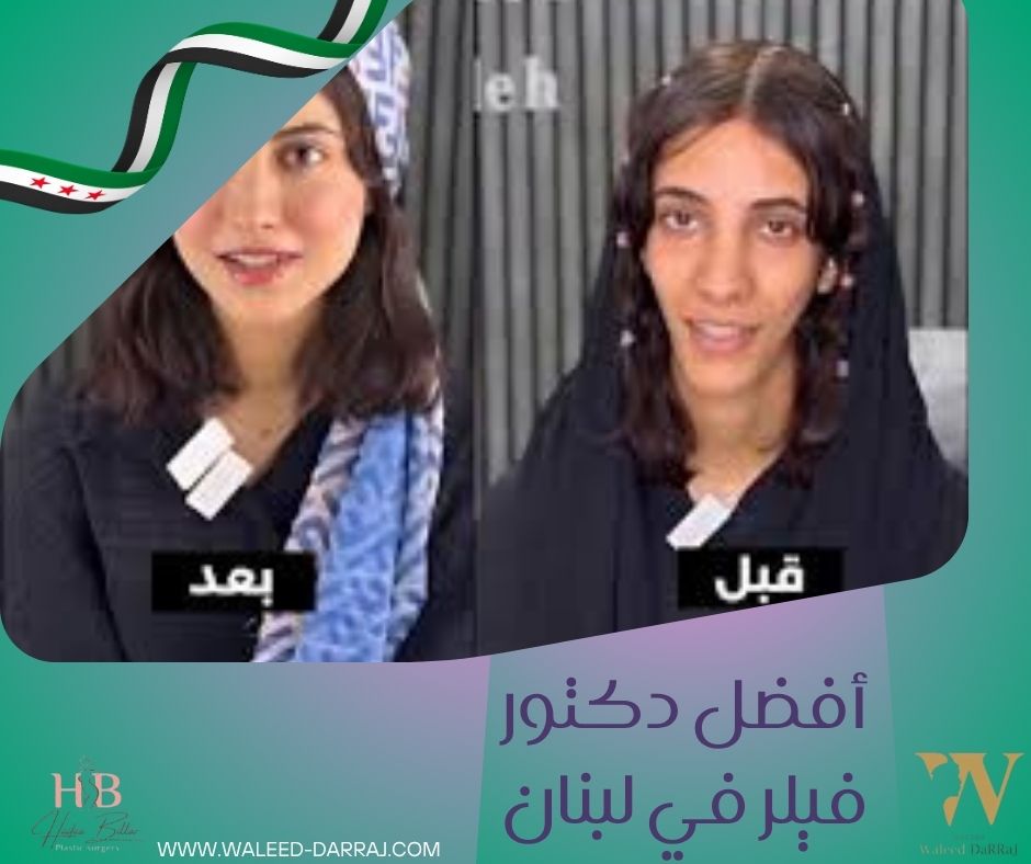 أفضل دكتور فيلر في لبنان
