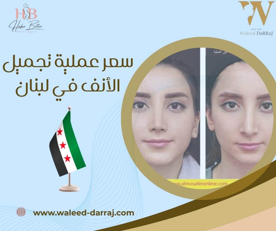 سعر عملية تجميل الأنف في لبنان