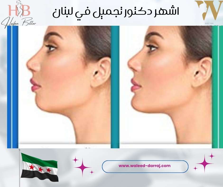 اشهر دكتور تجميل في لبنان