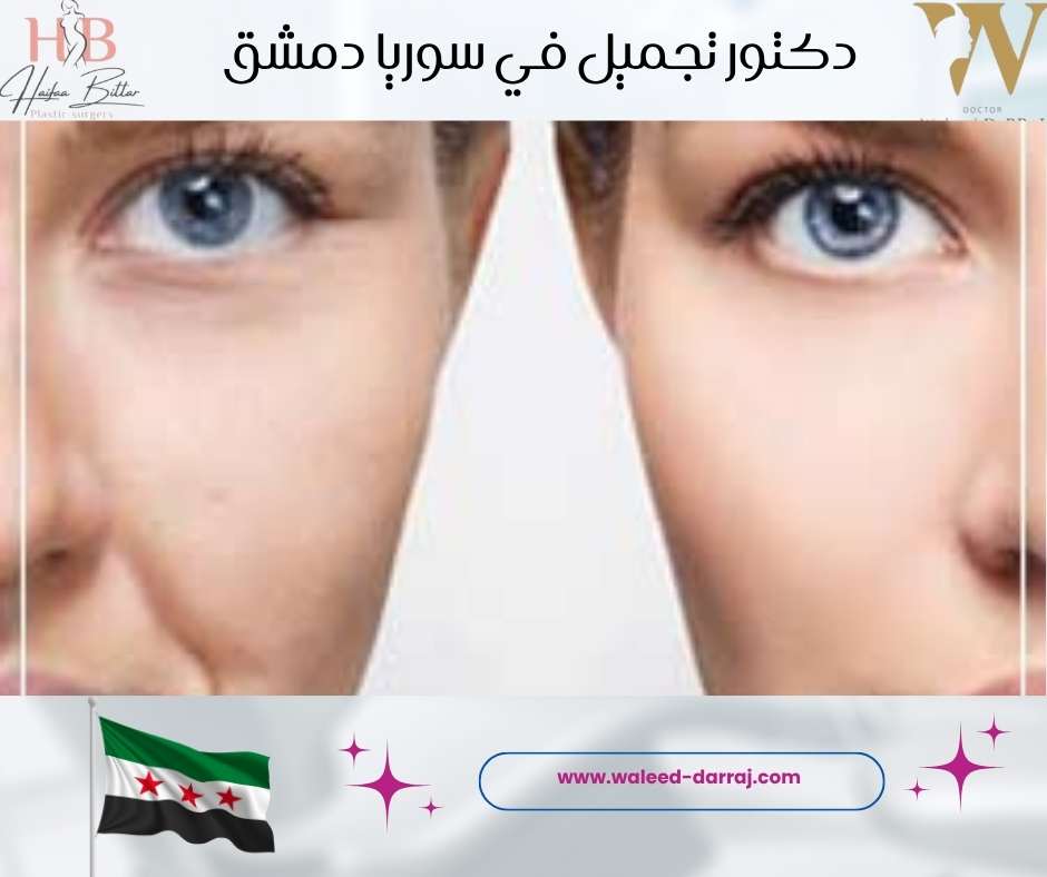 دكتور تجميل في سوريا دمشق