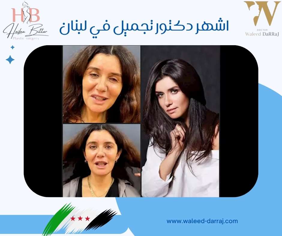 اشهر دكتور تجميل في لبنان