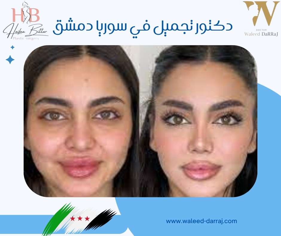 دكتور تجميل في سوريا دمشق