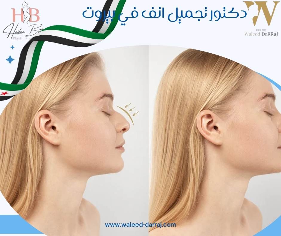 دكتور تجميل انف في بيروت