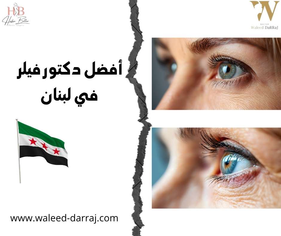 أفضل دكتور فيلر في لبنان