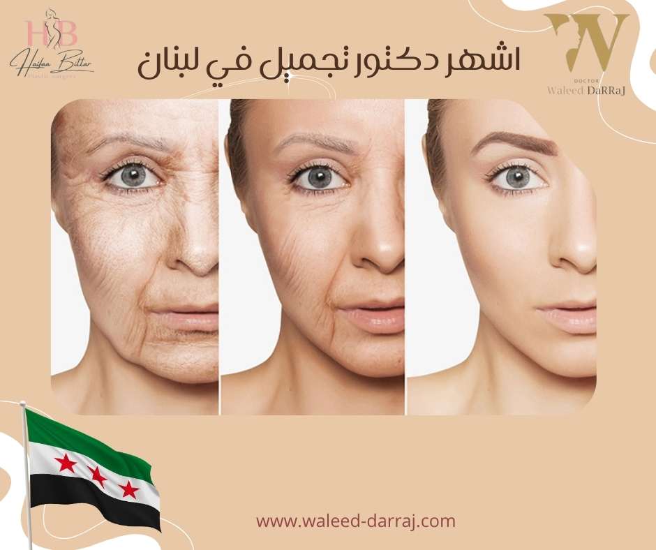 اشهر دكتور تجميل في لبنان