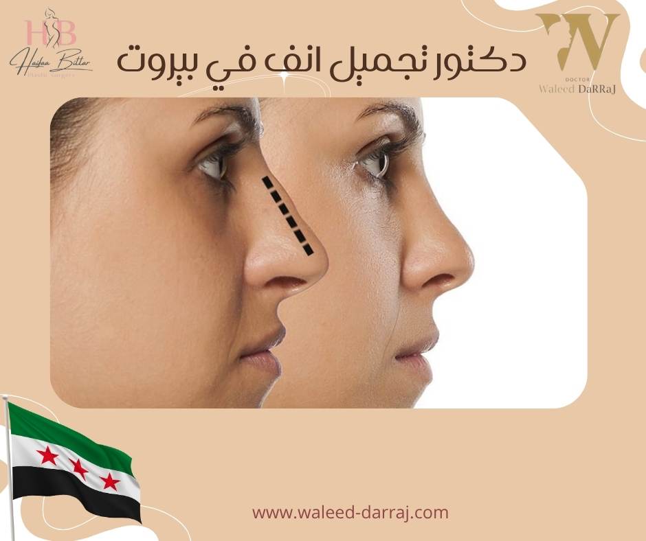 دكتور تجميل انف في بيروت