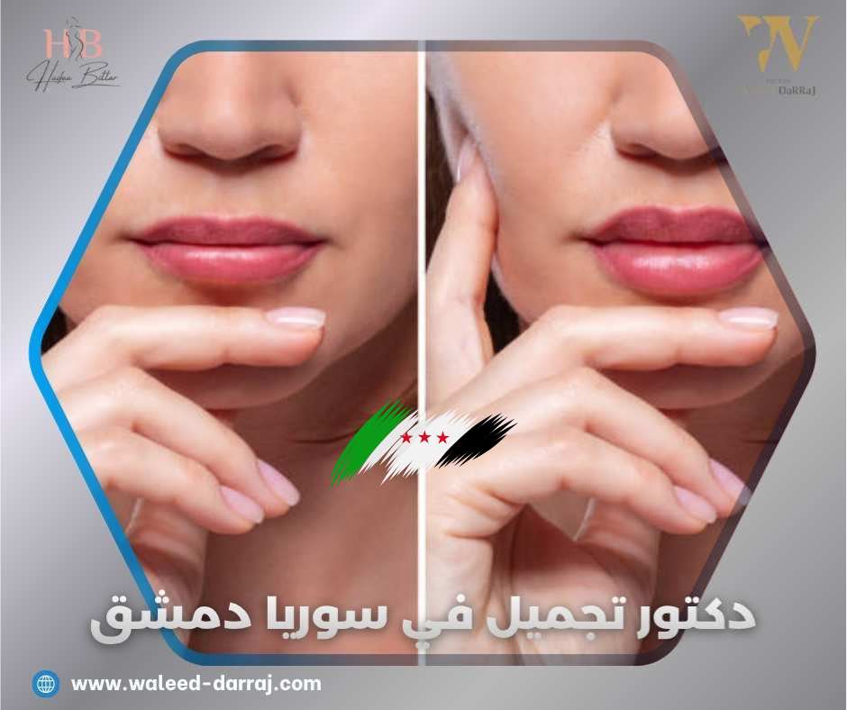 دكتور تجميل في سوريا دمشق