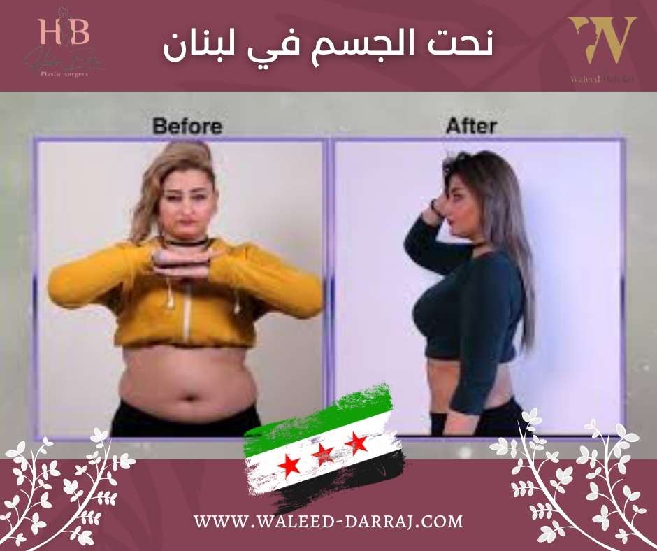 نحت الجسم في لبنان